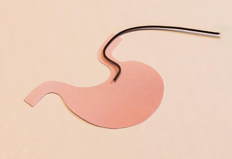 胃カメライメージ画像